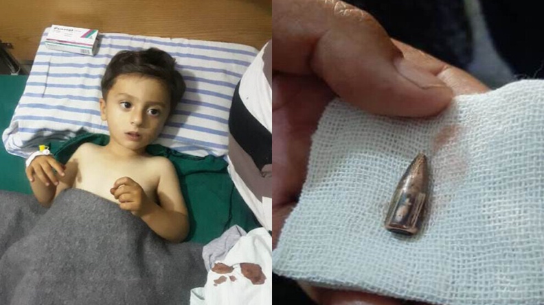 Το τουρκικό κράτος και οι μισθοφόροι του τραυμάτισαν 3χρονο παιδάκι στη Σεράβα