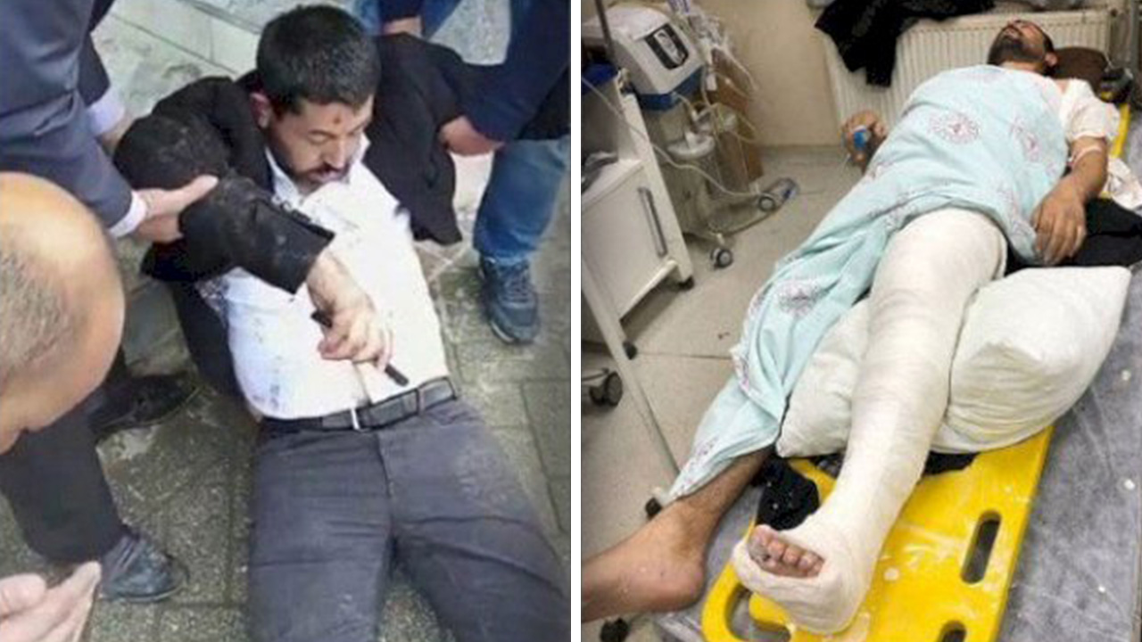 Κούρδος βουλευτής νοσηλεύεται στο νοσοκομείο και εκατοντάδες συνελήφθησαν στην Τουρκία σε συγκεντρώσεις για τον Οτσαλάν